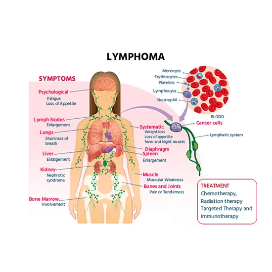 lymphoma basic panel test
